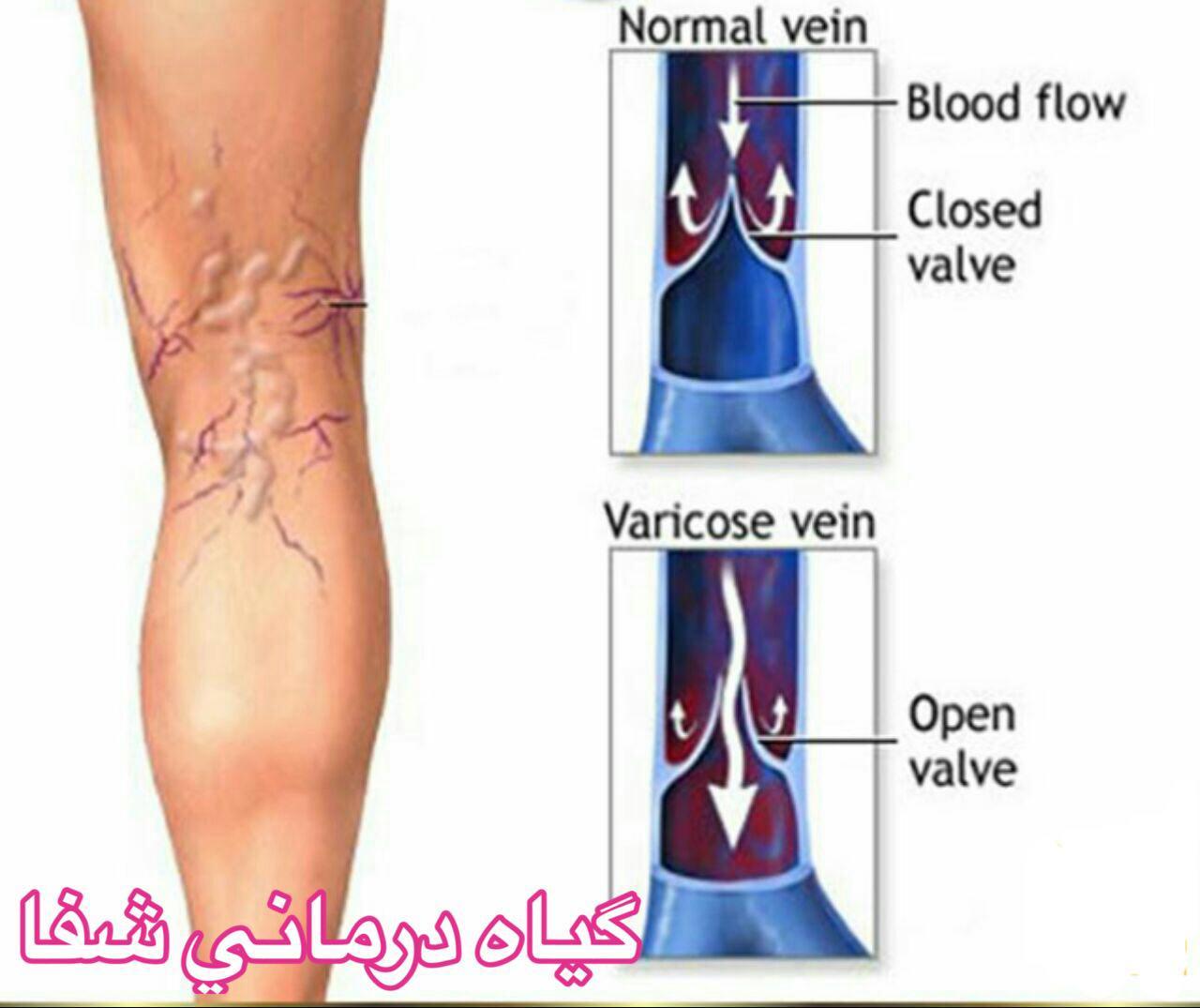 عکس پروفایل تلگرام اینستاگرام واتساپ لاین ایمو دخترونه پسرونه عاشقانه عاشقونه تکی دونفره مفهومی اورداپ چت گل دریا الناز33